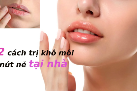 12 cách trị khô môi nứt nẻ tại nhà hiệu quả không thể bỏ qua